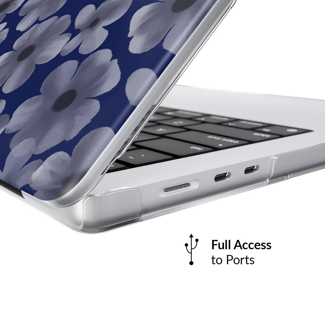 VELVET CAVIAR MacBook Case - Thumbnail 2
