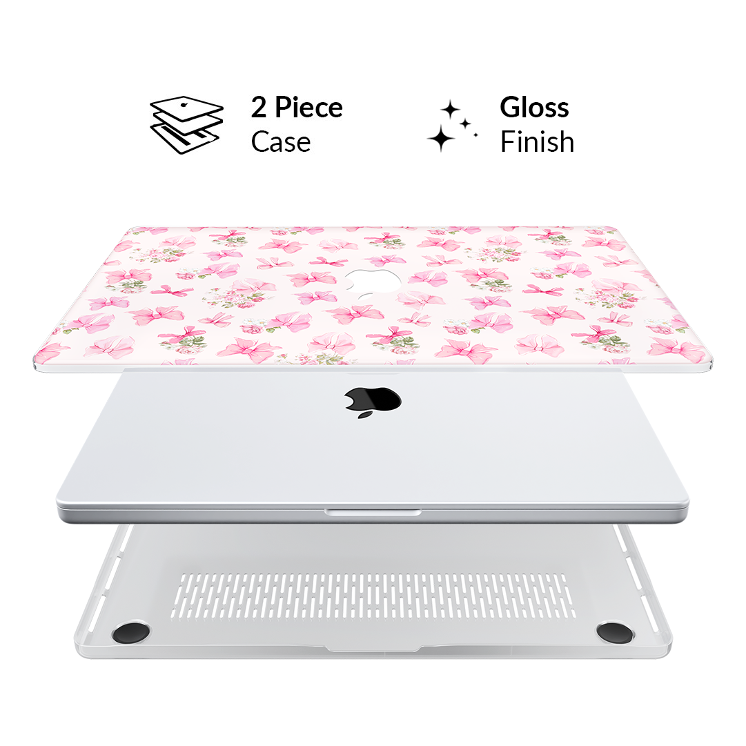 VELVET CAVIAR MacBook Case - Thumbnail 3