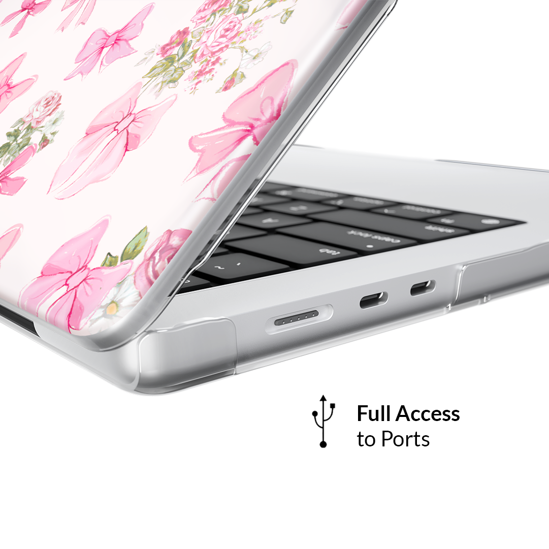 VELVET CAVIAR MacBook Case - Thumbnail 4
