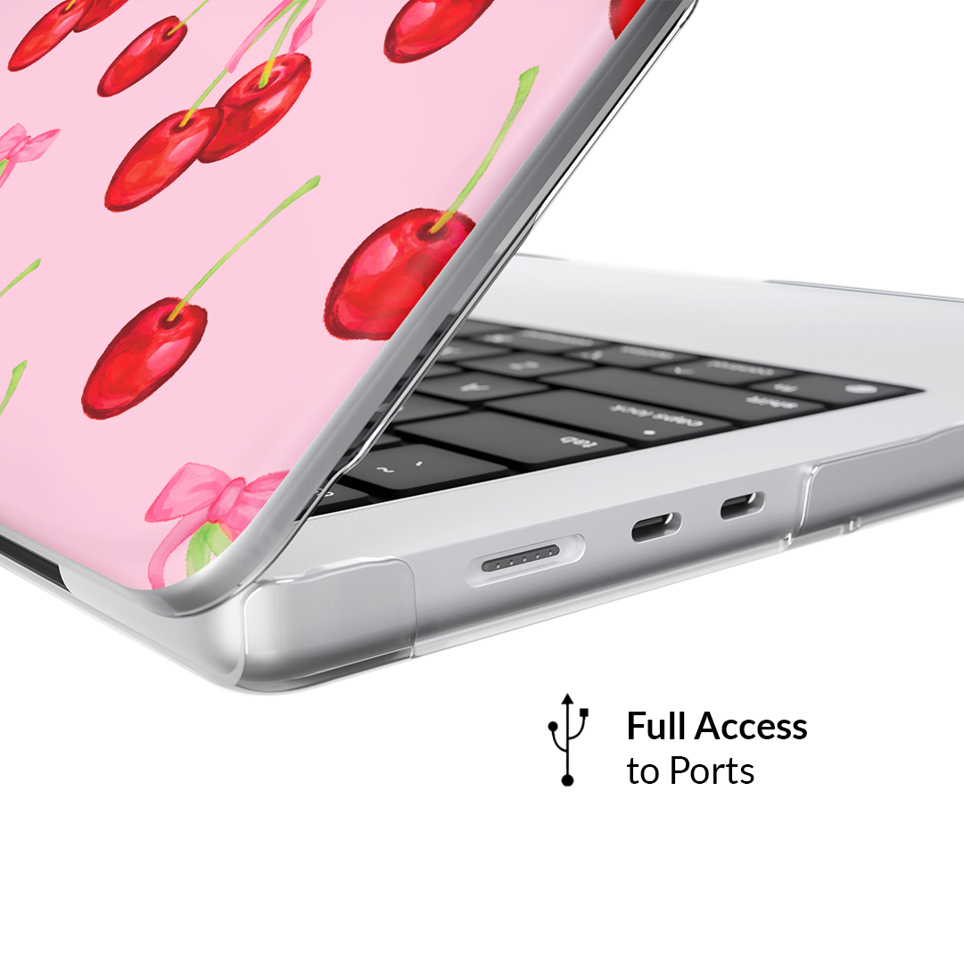 Sweet Cherry MacBook Case - Thumbnail 5