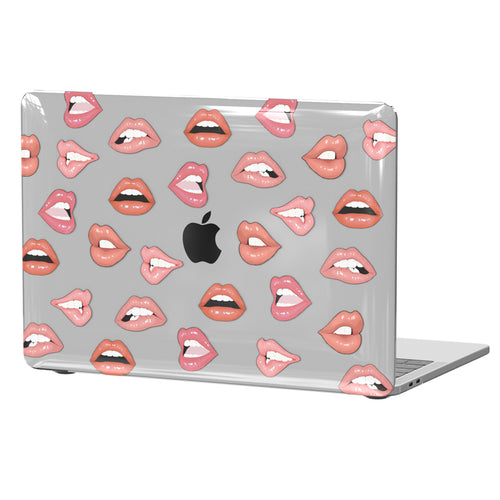Nude Lips MacBook Case