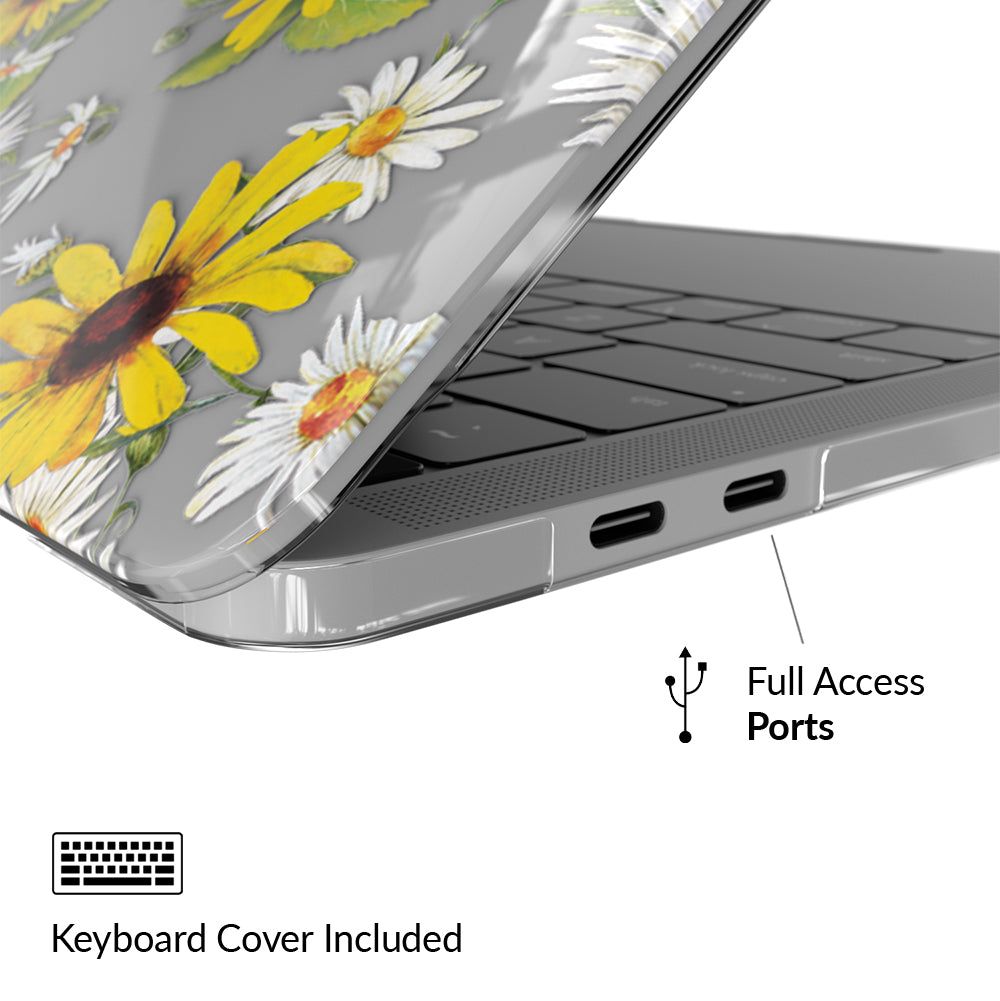 VELVET CAVIAR MacBook Case - Thumbnail 4